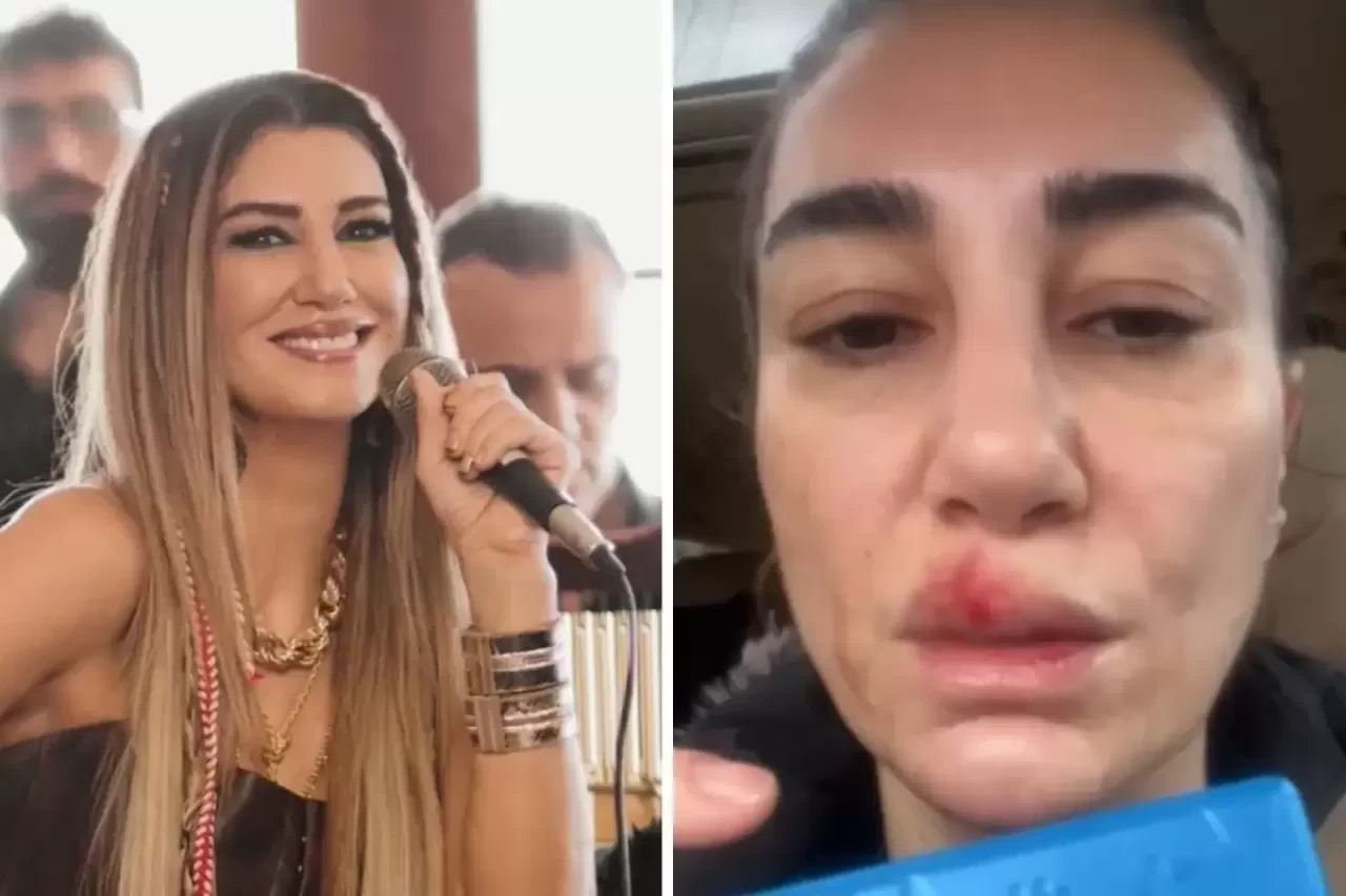 Şarkıcı Nadide Sultan kaza geçirdi! Elleriyle yüzünü Sakladı