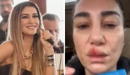 Şarkıcı Nadide Sultan kaza geçirdi! Elleriyle yüzünü Sakladı