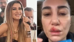 Şarkıcı Nadide Sultan kaza geçirdi! Elleriyle yüzünü Sakladı