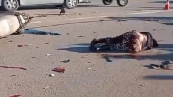 Fethiye Çatalarık’ta Feci Trafik Kazası: 2 Yaralı